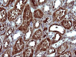 SERPINB3 Antibody (clone OTI1G5)