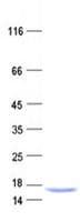 Human INTS6 Protein (Recombinant His, N-Terminal)