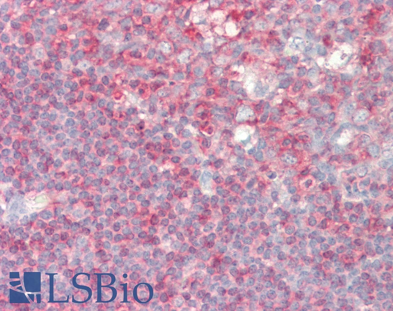 IHC-plus™ PIP5K1A Antibody (Internal)