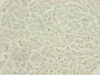 Polyclonal Rabbit anti-Human CAMK2D / CaMKII Delta Antibody (IHC)