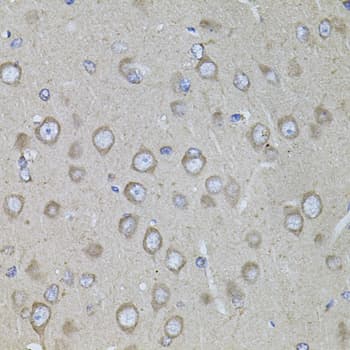 CRFR1 / CRHR1 Antibody