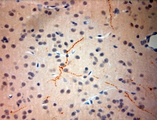 Polyclonal Rabbit anti-Rat SYNPO / Synaptopodin Antibody (aa890-930, IHC)