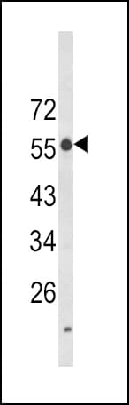 Polyclonal Rabbit anti-Human LAG3 Antibody (aa103-132, IHC, WB)