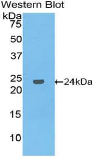 MLST8 / GBL Antibody (aa69-247, Cy3)