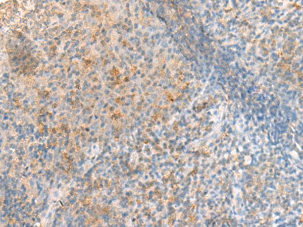 METT11D1 Antibody
