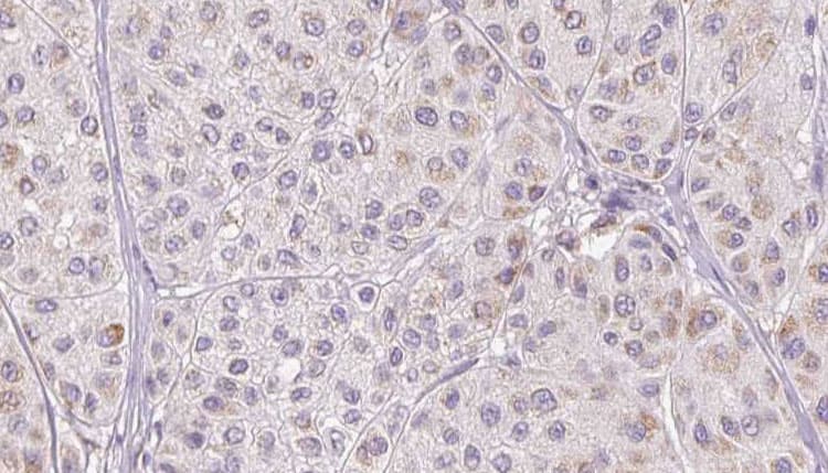 CFHR1 Antibody