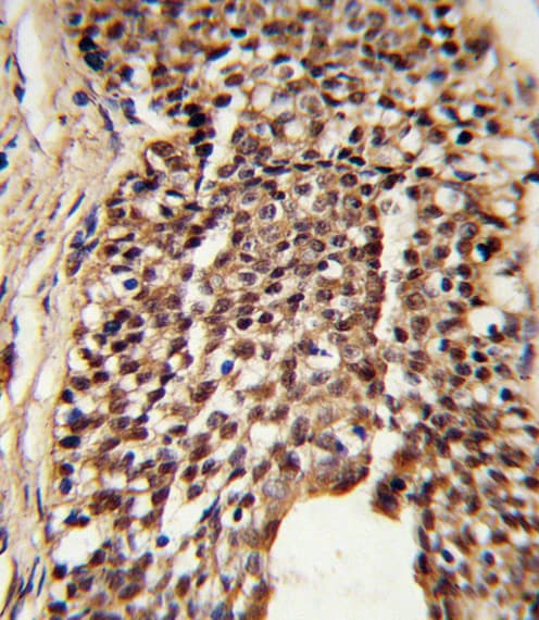 TPI1 / TPI Antibody (aa68-96)