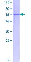 Human BLVRA Protein (Recombinant GST)