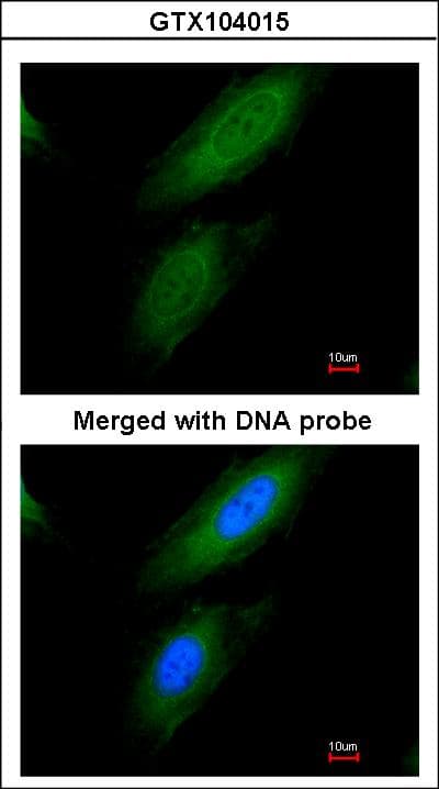 IHC-plus™ PDHA1 / PDH E1 Alpha Antibody (aa39-325)