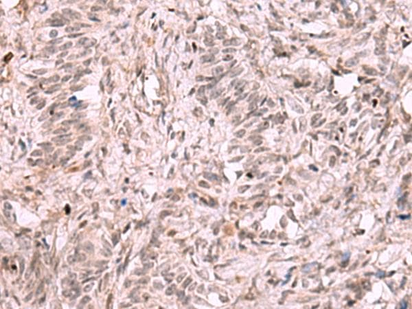 KDM7A / JHDM1D Antibody