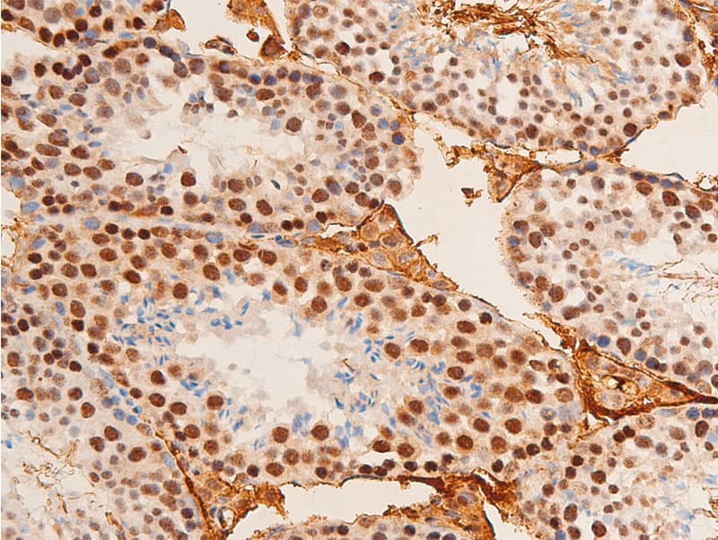 Polyclonal Rabbit anti-Human JUN / c-Jun Antibody (phospho-Thr91, IHC, WB)