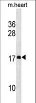 DAPL1 Antibody (aa20-48)