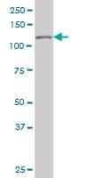 TP53BP2 / ASPP2 Antibody (clone 3F8)