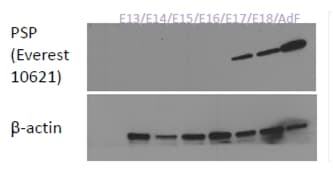 Polyclonal Goat anti-Human BPIFA2 / SPLUNC2 Antibody (aa146-160, WB)