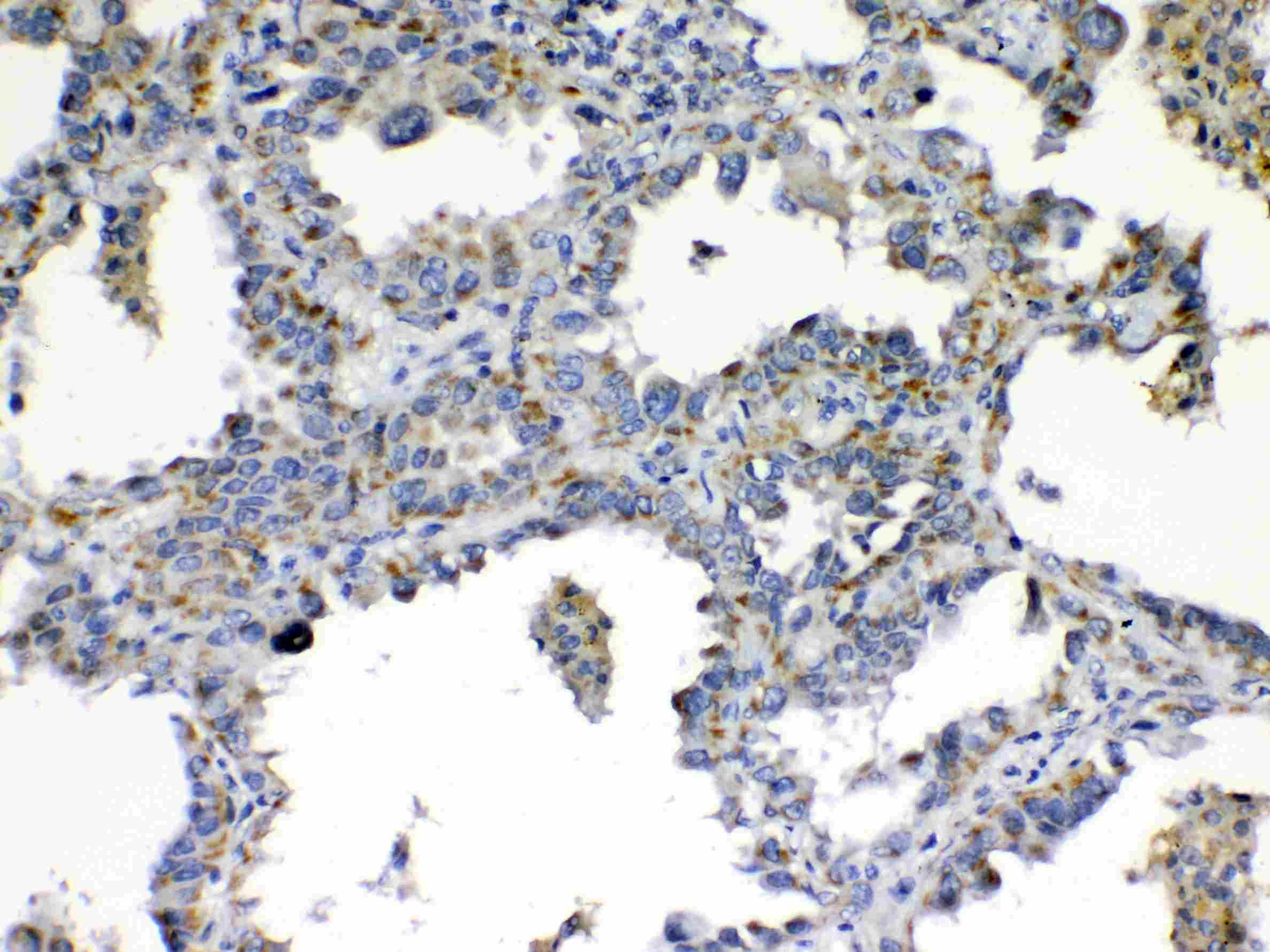 Polyclonal Rabbit anti-Human TIMP4 Antibody (IHC, WB)
