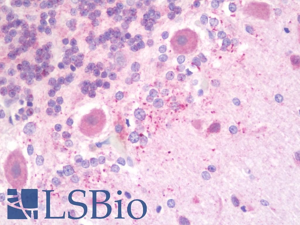 IHC-plus™ DAB1 Antibody (aa201-250)
