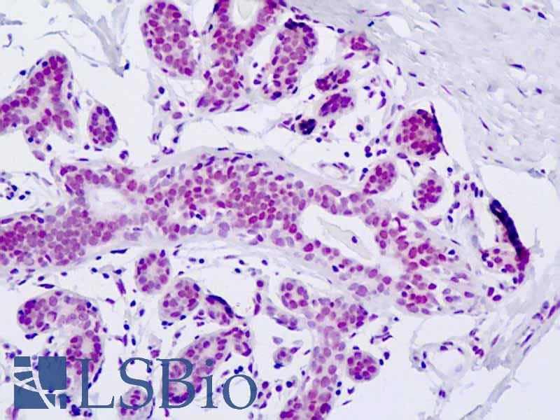 IHC-plus™ Polyclonal Rabbit anti-Human ZMYND8 / RACK7 Antibody (aa581-630, IHC, WB)