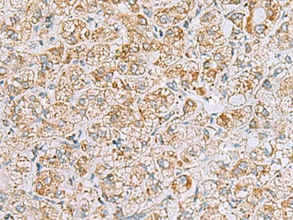 Insulin Antibody