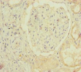 Polyclonal Rabbit anti-Human MOCS2 Antibody (IHC, IF, WB)