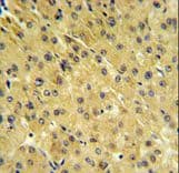 FOLH1B Antibody (aa155-183)