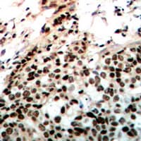 Polyclonal Rabbit anti-Human PRKDC / DNA-PKcs Antibody (phospho-Thr2647, IHC, IF, WB)