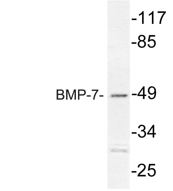 Polyclonal Rabbit anti-Human BMP7 Antibody (aa124-173, IHC, WB)