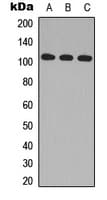 Polyclonal Rabbit anti-Human MAP3K10 / MLK2 Antibody (Internal, IHC, WB)
