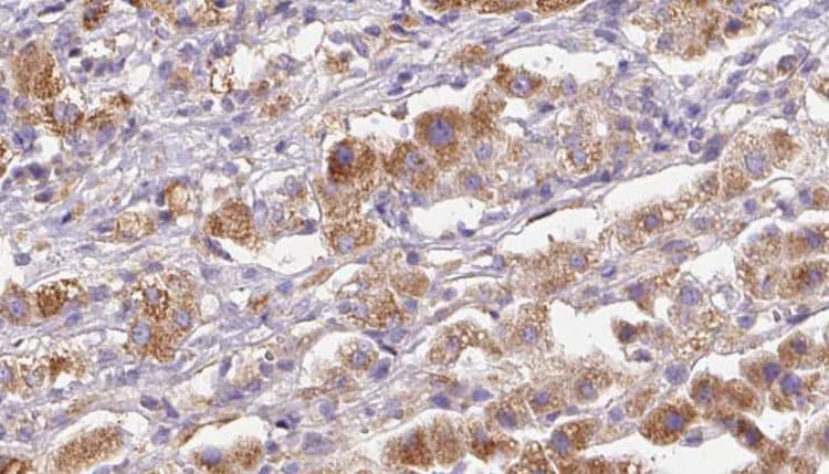 GRIK5 / KA2 Antibody