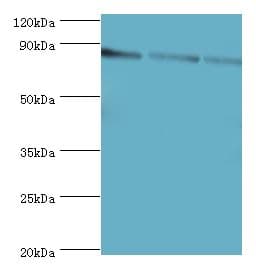 CDH6 / K Cadherin Antibody (aa1-250)