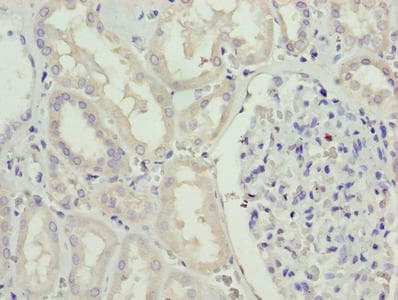 Polyclonal Rabbit anti-Human SDSL / Serine Dehydratase-Like Antibody (IHC, WB)