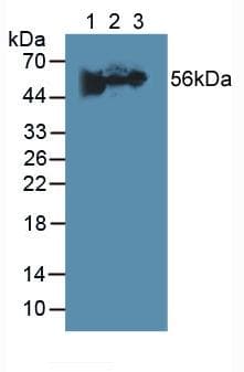 FGB / Fibrinogen Beta Chain Antibody (aa45-491)