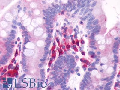 PathPlus™ GPR39 Antibody (Extracellular Domain)