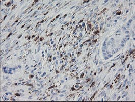 F13A1 / Factor XIIIa Antibody (clone OTI9E2)