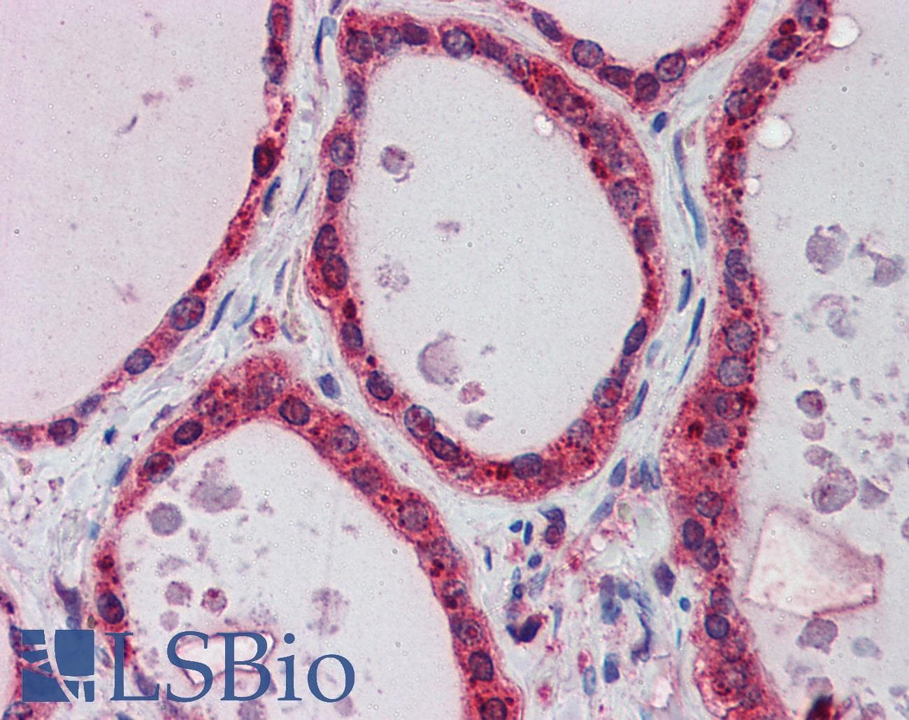 Polyclonal Rabbit anti-Human AKR1B1 / Aldose Reductase Antibody (N-Terminus, IHC, WB)