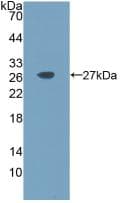 Human IL11 Protein (Recombinant His, N-Terminal)