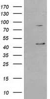 SERPINB3 Antibody (clone OTI3C2)