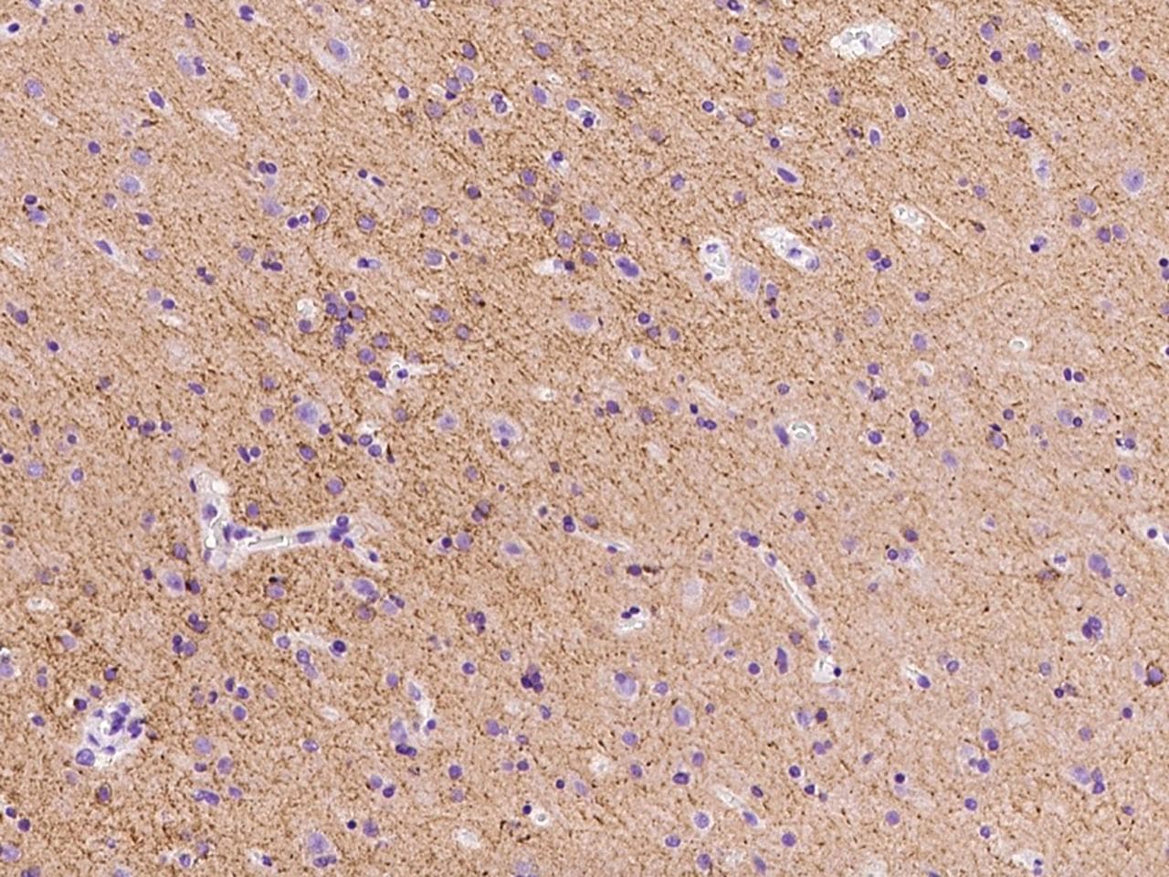 SLC12A5 / KCC2 Antibody