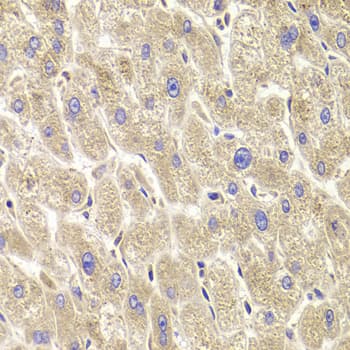 TRP32 / TXNL1 Antibody