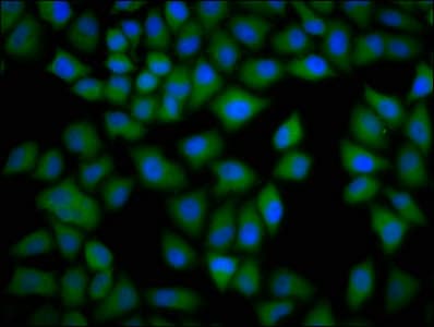 Polyclonal Rabbit anti-Human CKAP4 Antibody (WB)