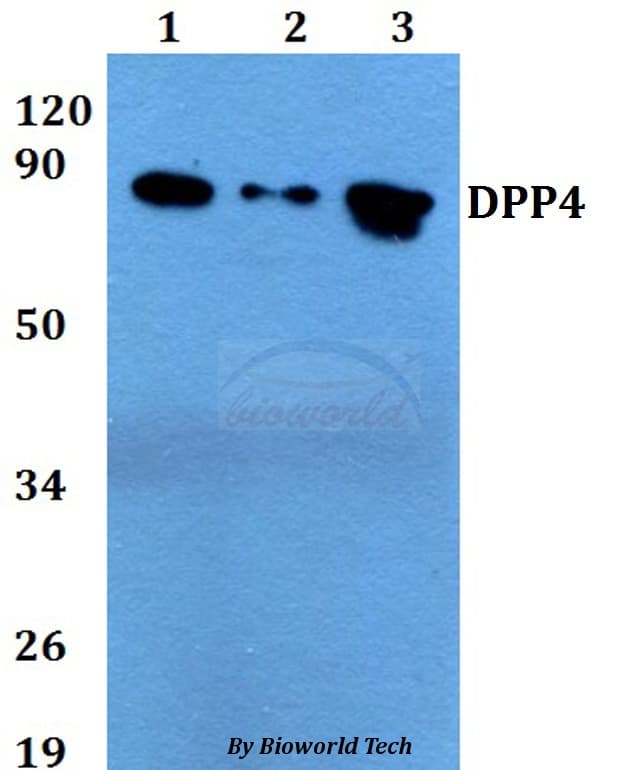 Polyclonal Rabbit anti-Human DPP4 / CD26 Antibody (WB)