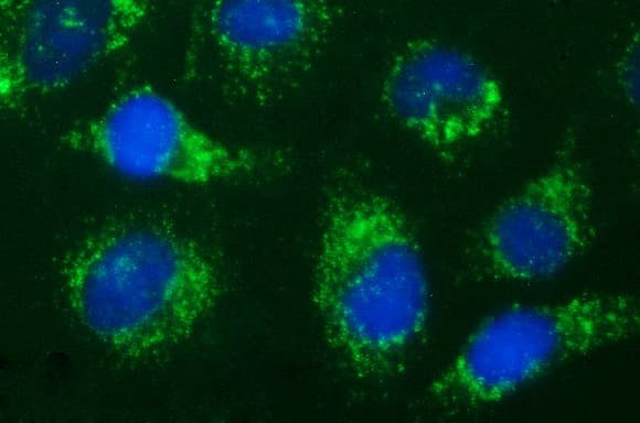 HSD17B4 Antibody (clone OTI2C9)