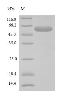Mouse FBXW10 Protein (Recombinant 6His-SUMO, N-terminus)