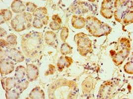 SIRT3 / Sirtuin 3 Antibody (aa20-130)