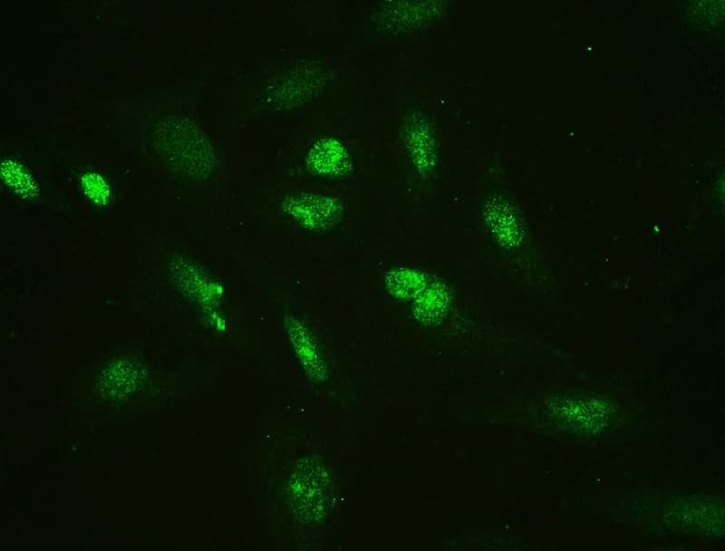 HMG2 / HMGB2 Antibody