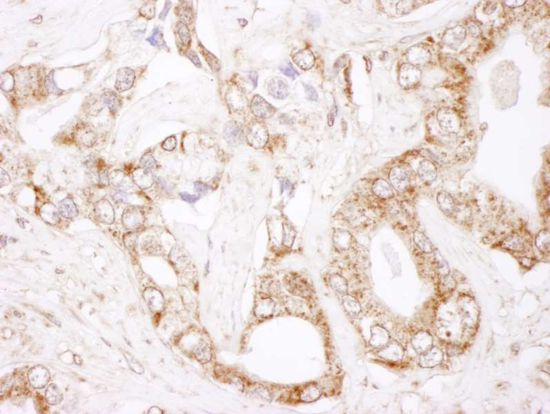 BCL2 / Bcl-2 Antibody (aa50-100)