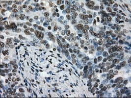 L1CAM Antibody (clone OTI2A6, Carrier-free)