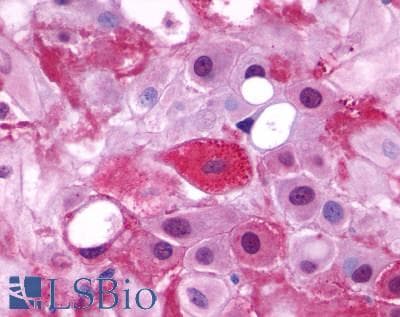 PathPlus™ LHCGR / LHR / LH Receptor Antibody (C-Terminus)