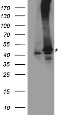 Polyclonal Rabbit anti-Human RAD51 / RECA Antibody (WB)