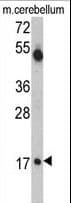 Polyclonal Rabbit anti-Human UEV1 / UEV1A Antibody (aa113-145, WB)