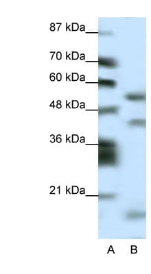 LHX1 Antibody (aa120-169)